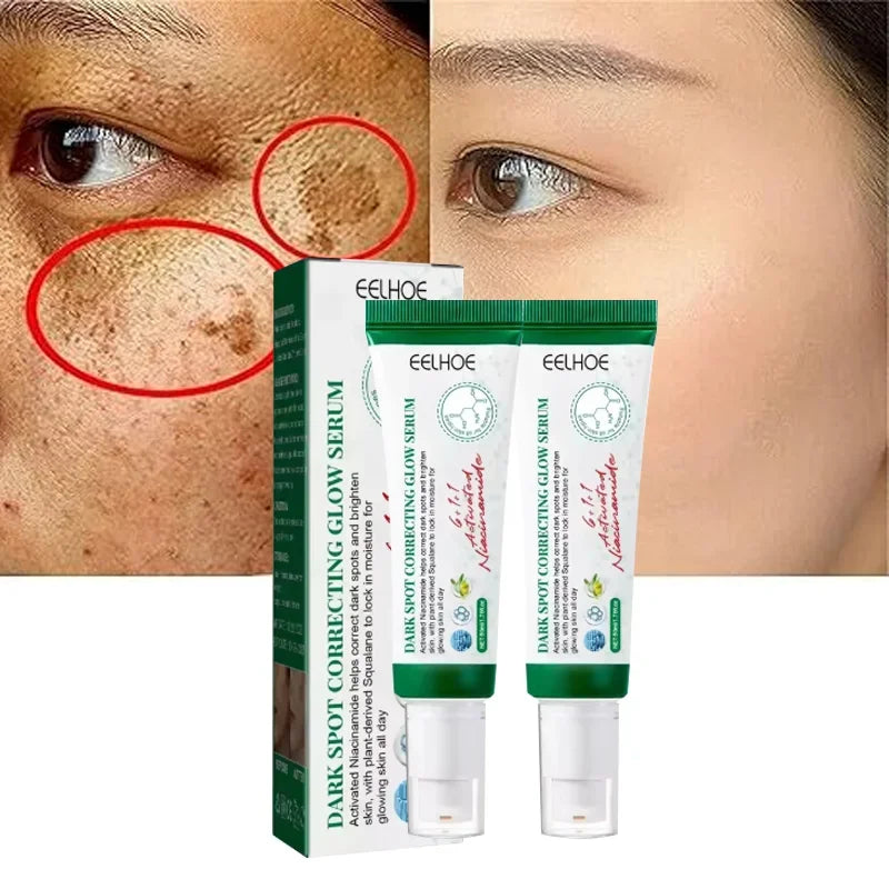Royal Glow Dark Spot Brightening Cream