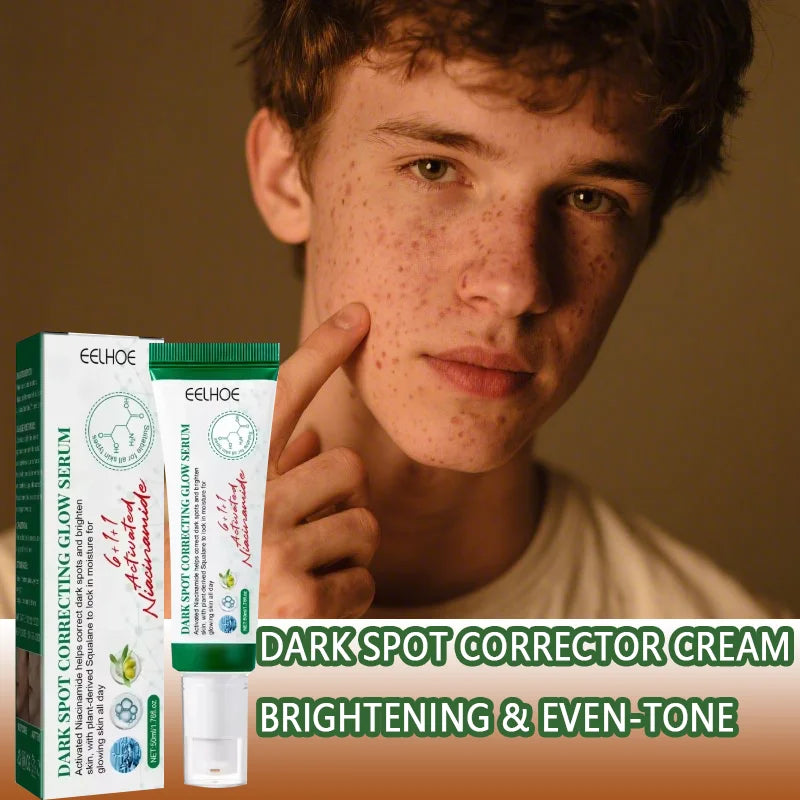 Royal Glow Dark Spot Brightening Cream