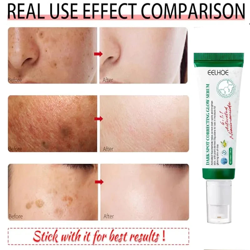 Royal Glow Dark Spot Brightening Cream